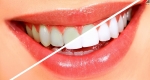  خمیر دندان سفید کننده خانگی