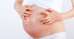 خشکی پوست در بارداری نشانه چیست؟