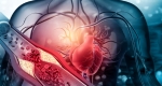 شناسایی یک نوع ژل برای جوانسازی سلول های قلب