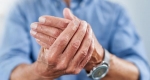 تمرینات ورزشی برای درمان آرتروز انگشتان دست